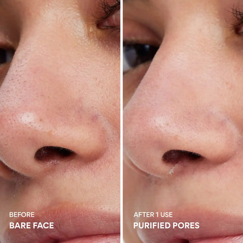 Super Volcanic Pore Clay Mask – Deep Cleanse & Clear Face Pores